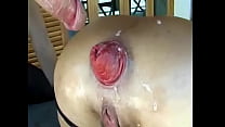 hd порно странная милфа мамы хардкорный анальный фистинг пролапс porn