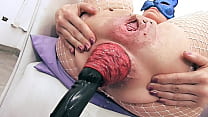hd most incredible prolapse scene cervix fisting max stretch porn