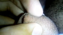 hd would they fuck their penis like that fordyce glands not disease nor contagious porn
