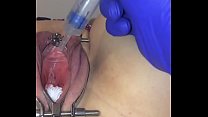 hd homemade female catheter tutorial porn