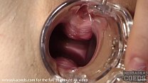 hd sexy nurse riki gyno speculum play gaping ginger pussy with closeups of pussy walls porn